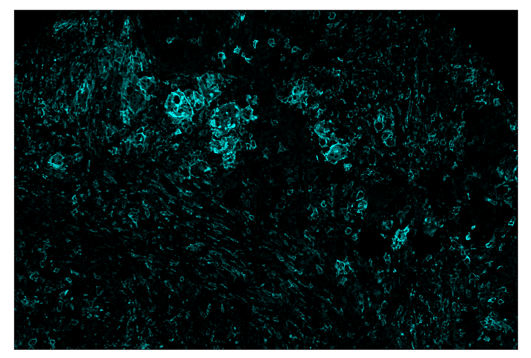 Immunohistochemistry Image 5: CD11c (D3V1E) & CO-0017-647 SignalStar™ Oligo-Antibody Pair