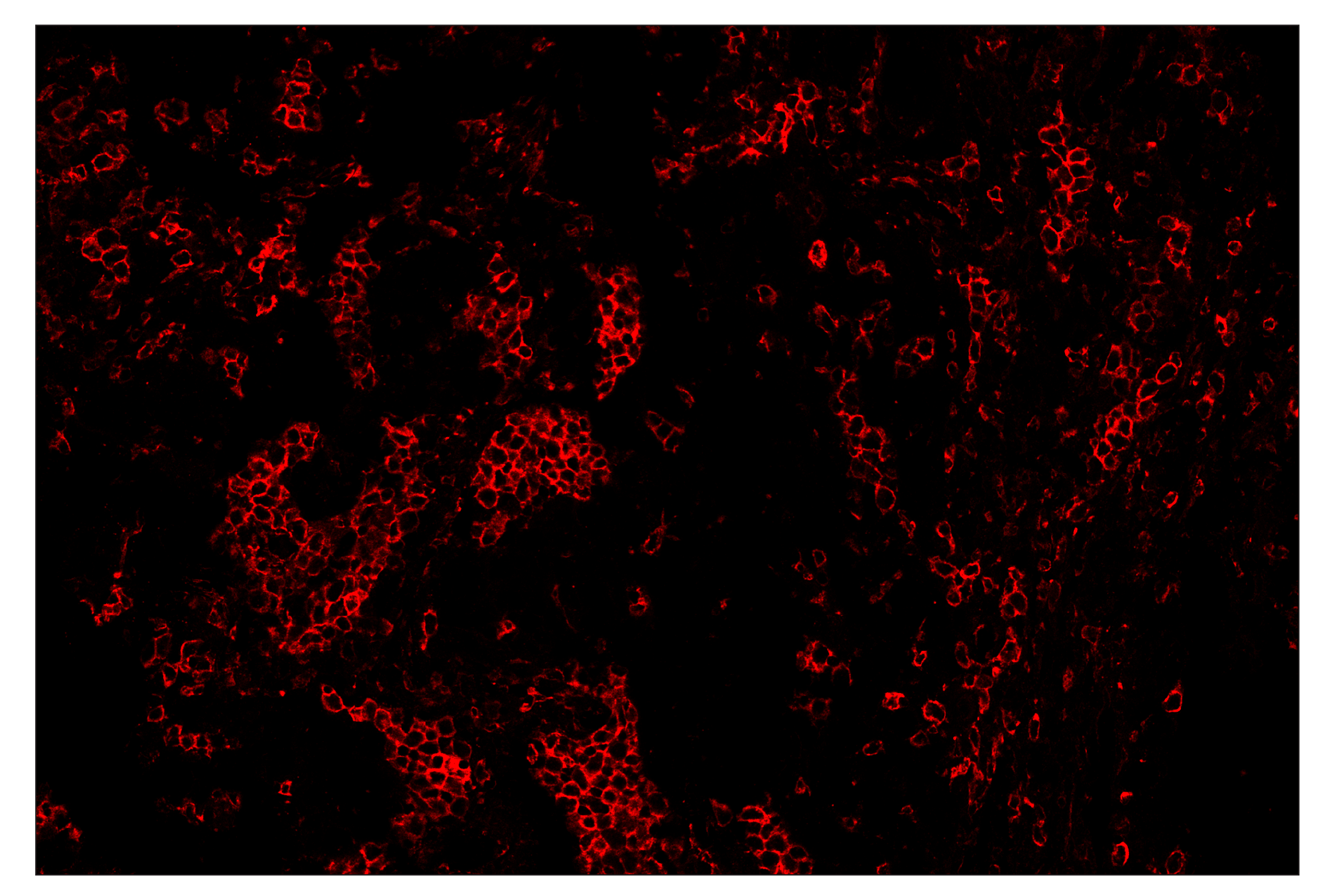 Immunohistochemistry Image 4: CD11c (D3V1E) & CO-0017-647 SignalStar™ Oligo-Antibody Pair