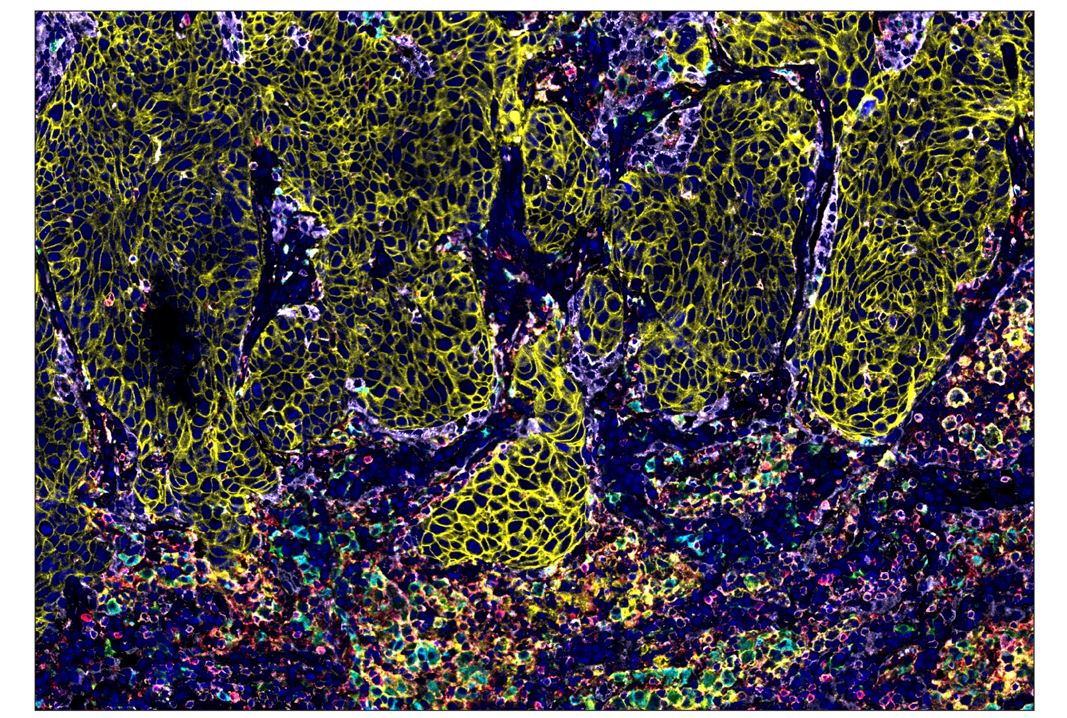 Immunohistochemistry Image 1: CD11c (D3V1E) & CO-0017-594 SignalStar™ Oligo-Antibody Pair