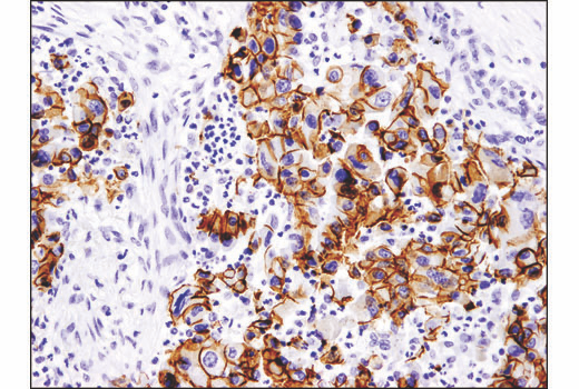 Immunohistochemistry Image 1: E-Cadherin (4A2) Mouse mAb (BSA and Azide Free)