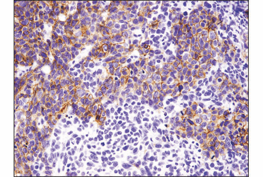 Immunohistochemistry Image 4: E-Cadherin (4A2) Mouse mAb (BSA and Azide Free)