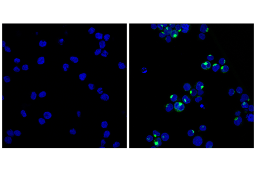 Immunofluorescence Image 1: IL-8 (E5F5Q) XP® Rabbit mAb