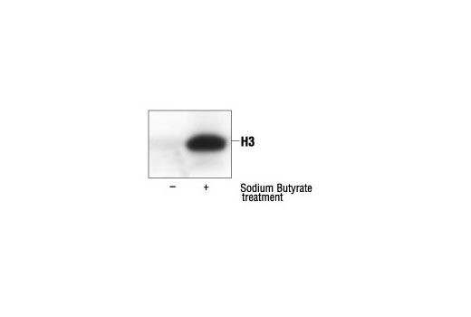 Western Blotting Image 1: Acetylated-Lysine Antibody