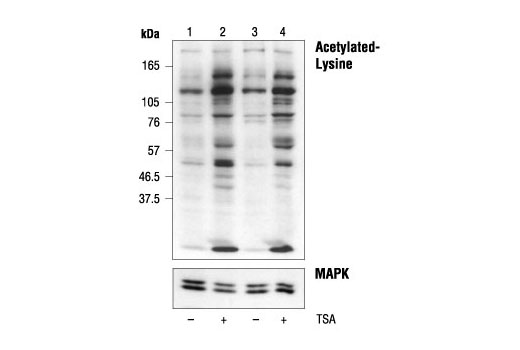 Western Blotting Image 3: Acetylated-Lysine Antibody