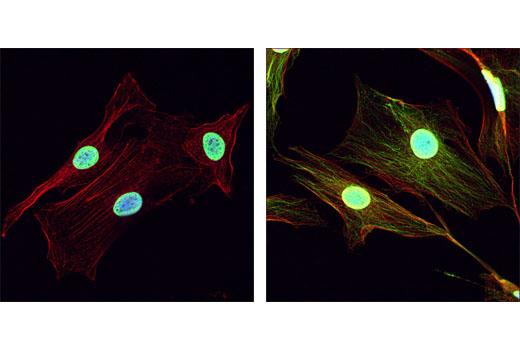 Immunofluorescence Image 1: Acetylated-Lysine Antibody