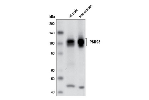 Western Blotting Image 1: PSD93 Antibody