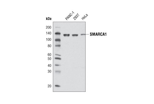 Western Blotting Image 1: SMARCA1 Antibody