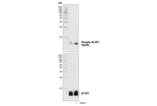 Western Blotting Image 1: Phospho-4E-BP1 (Ser65) Antibody