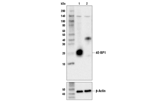 Western Blotting Image 1: 4E-BP1 Antibody
