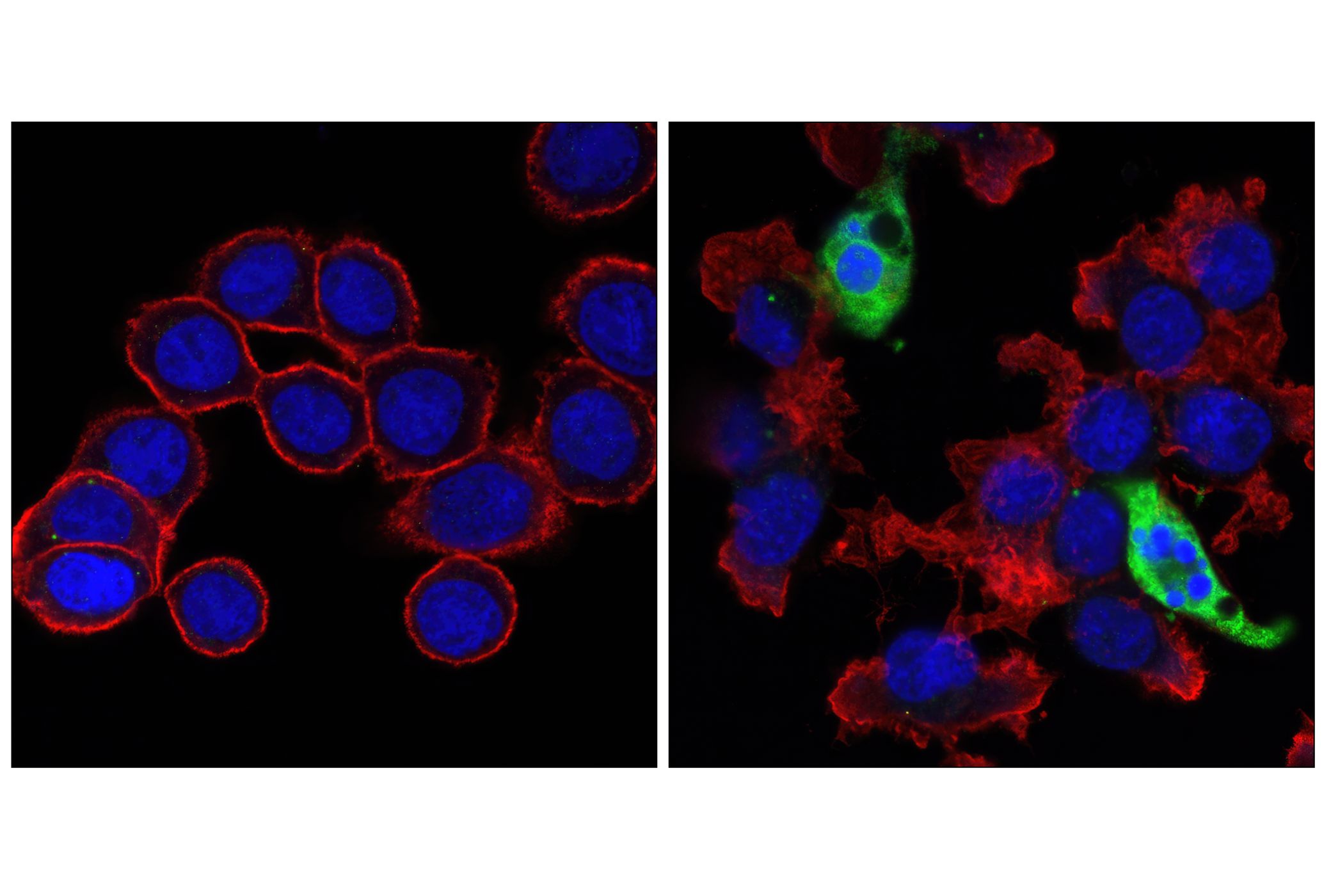 Immunofluorescence Image 1: Cleaved Caspase-3 (Asp175) (5A1E) Rabbit mAb (BSA and Azide Free)