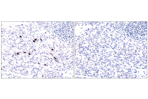 Immunohistochemistry Image 2: Cleaved Caspase-3 (Asp175) (5A1E) Rabbit mAb (BSA and Azide Free)