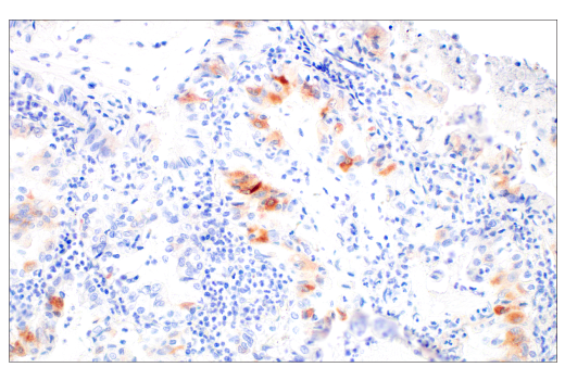 Immunohistochemistry Image 2: FGL1 (E7C1Q) XP® Rabbit mAb (BSA and Azide Free)