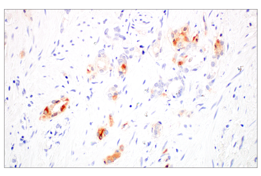 Immunohistochemistry Image 4: FGL1 (E7C1Q) XP® Rabbit mAb (BSA and Azide Free)