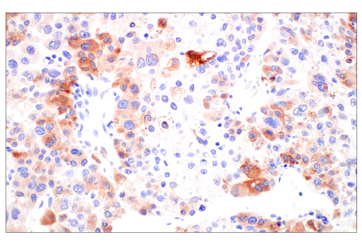 Immunohistochemistry Image 3: FGL1 (E7C1Q) XP® Rabbit mAb (BSA and Azide Free)