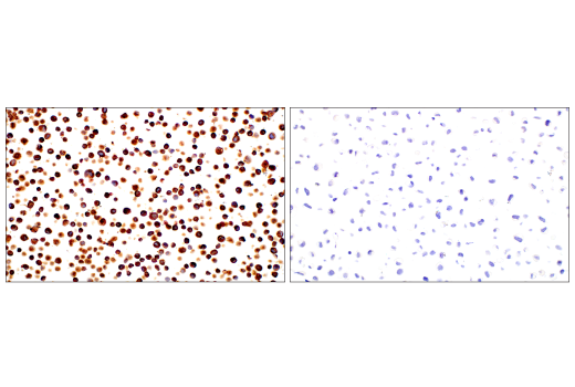 Immunohistochemistry Image 8: FGL1 (E7C1Q) XP® Rabbit mAb (BSA and Azide Free)