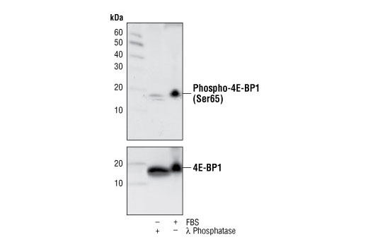 Western Blotting Image 1: Phospho-4E-BP1 (Ser65) (174A9) Rabbit mAb