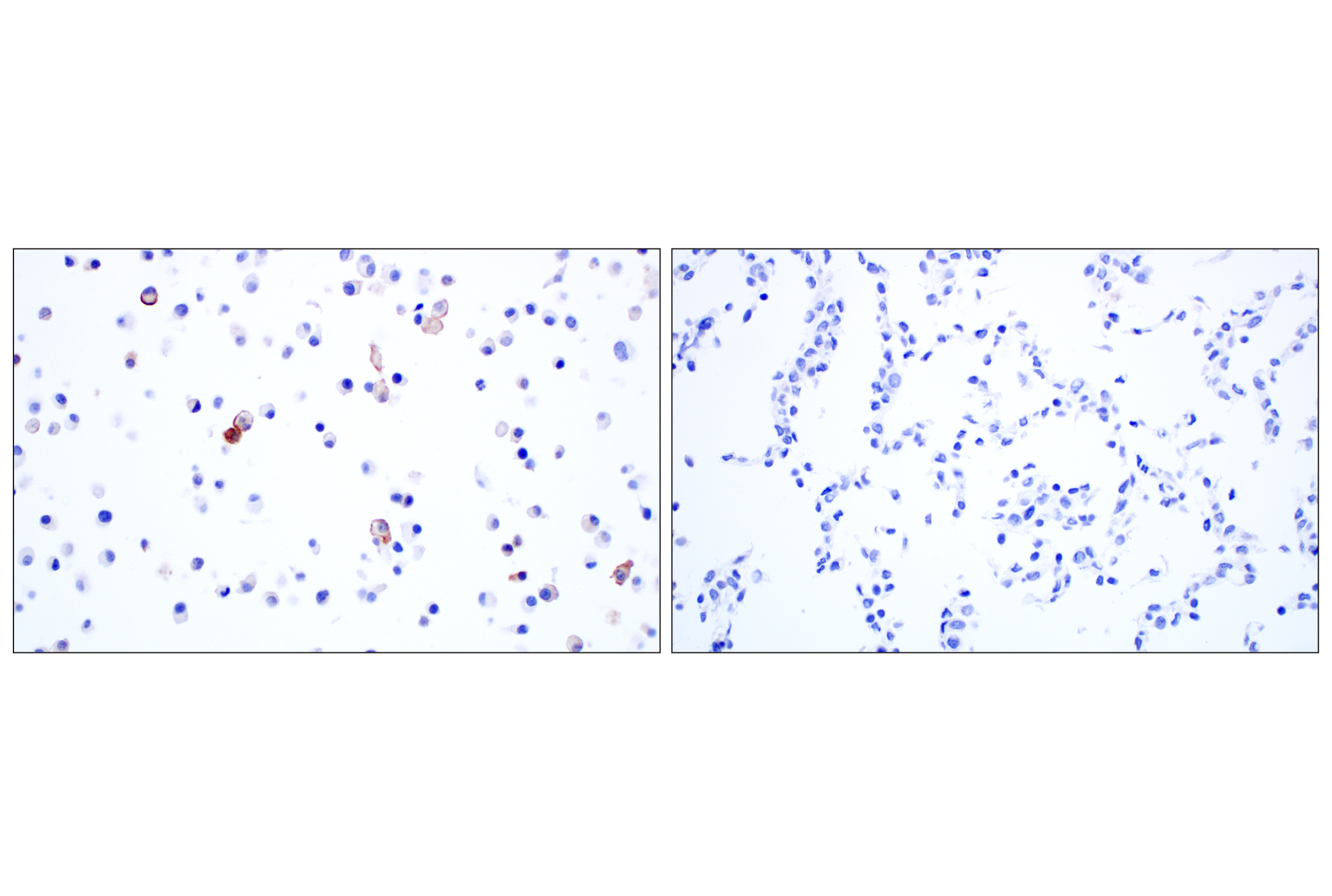 Immunohistochemistry Image 9: Siglec-1/CD169 (E1D7G) Rabbit mAb (BSA and Azide Free)