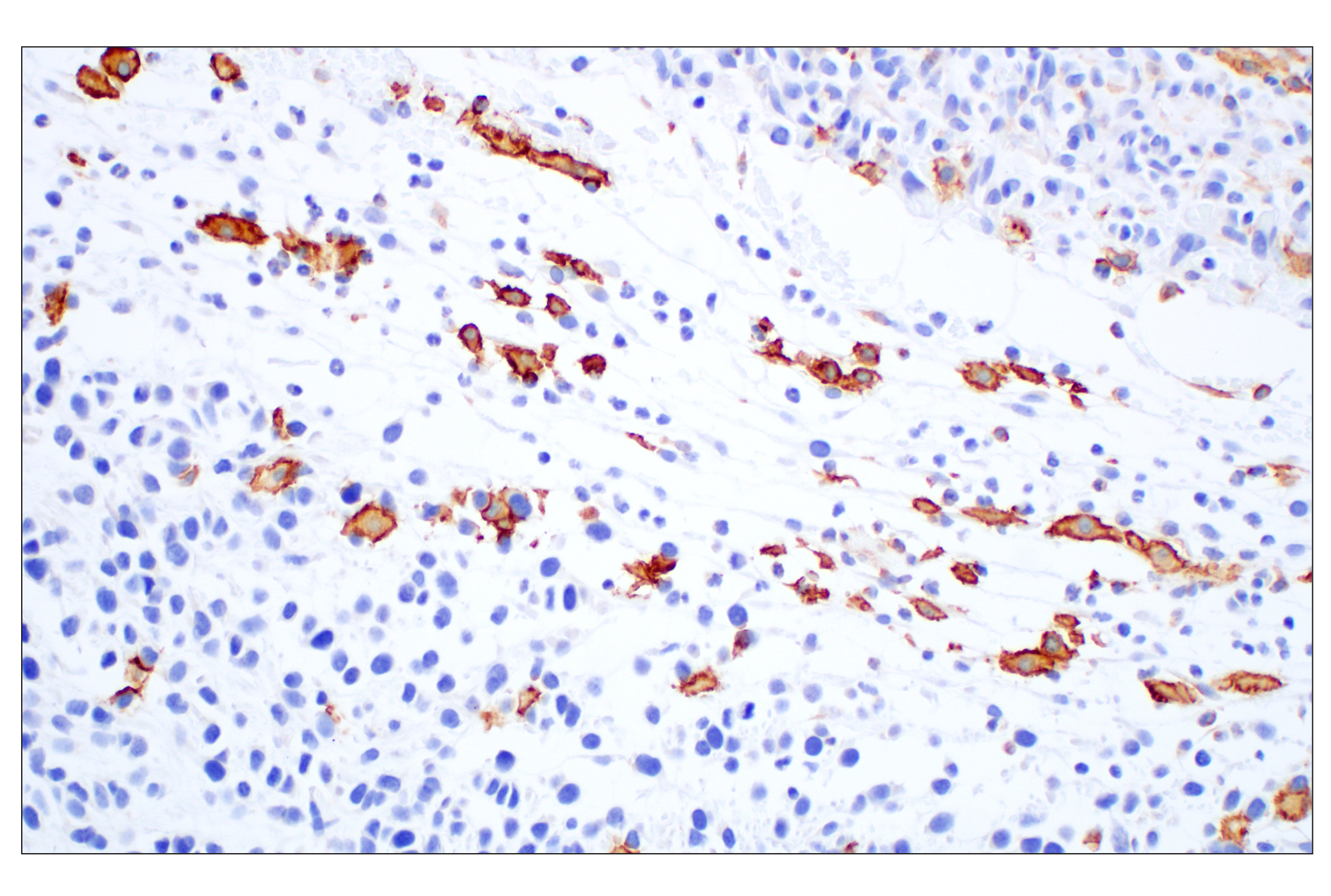 Immunohistochemistry Image 1: Siglec-1/CD169 (E1D7G) Rabbit mAb (BSA and Azide Free)