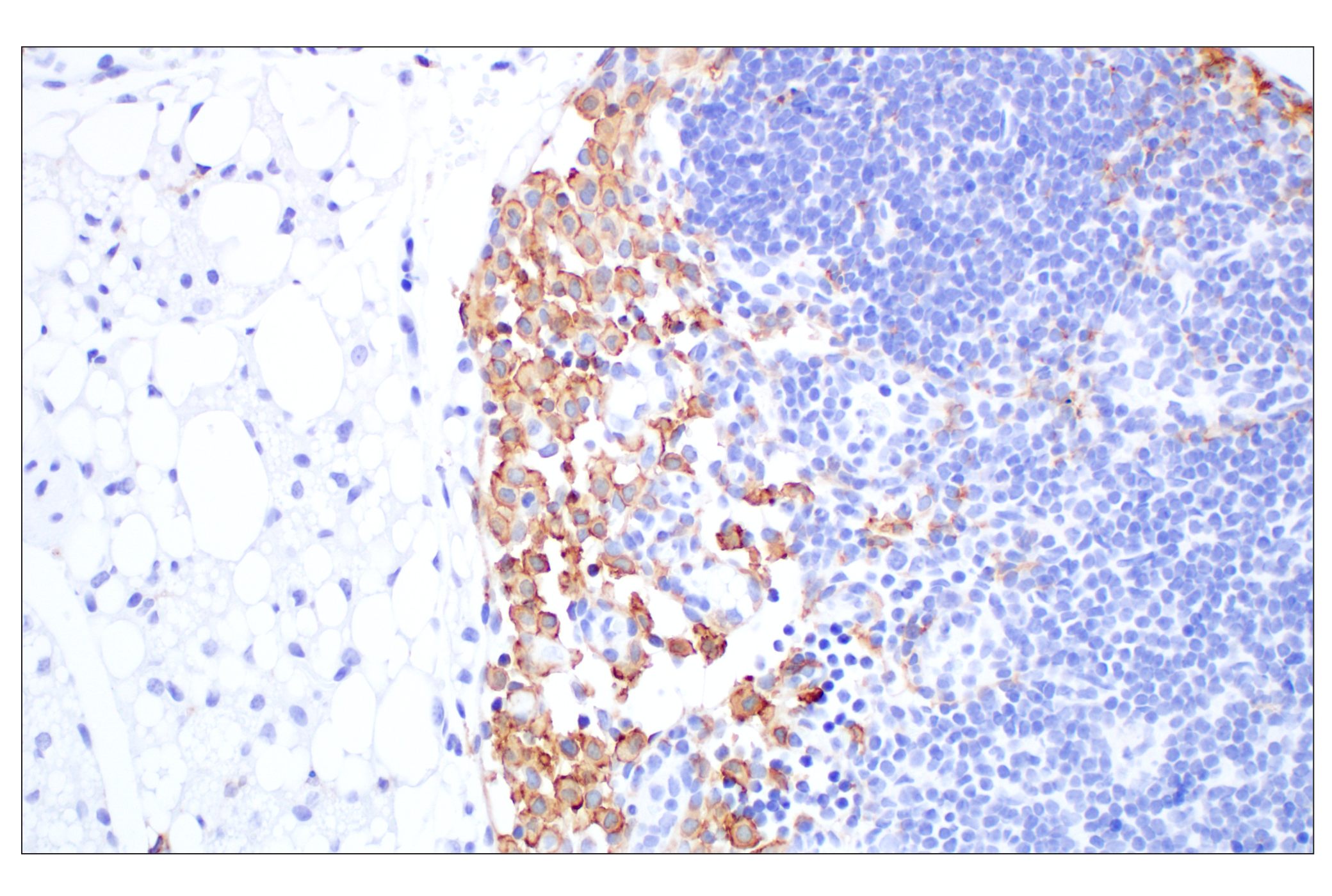 Immunohistochemistry Image 3: Siglec-1/CD169 (E1D7G) Rabbit mAb (BSA and Azide Free)