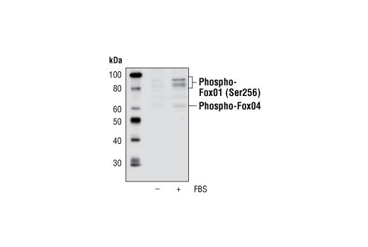 Western Blotting Image 1: Phospho-FoxO1 (Ser256) Antibody