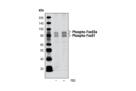 Western Blotting Image 1: Phospho-FoxO1 (Thr24)/FoxO3a (Thr32) Antibody