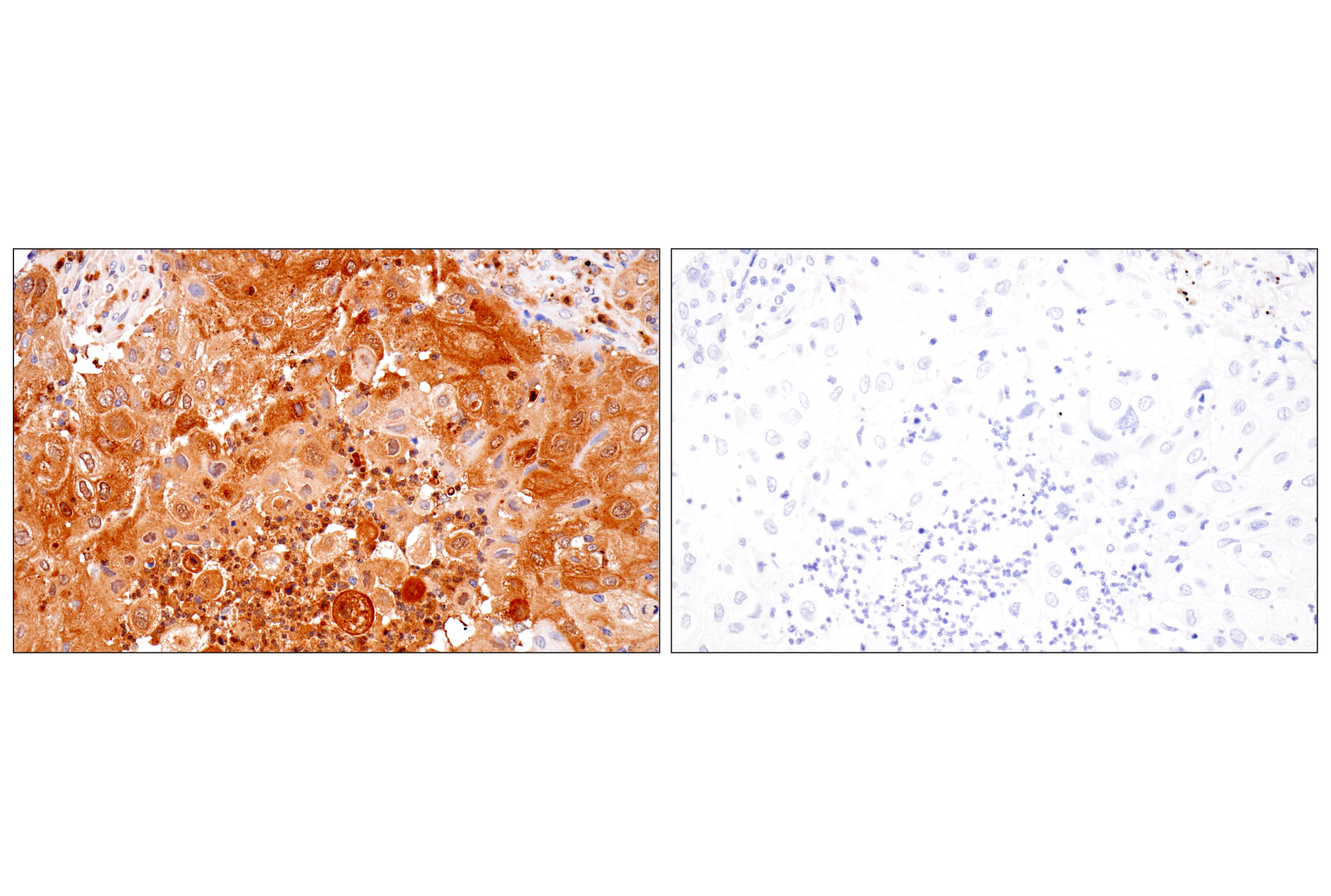 Immunohistochemistry Image 13: Cystatin-A (F5N5B) Rabbit Monoclonal Antibody