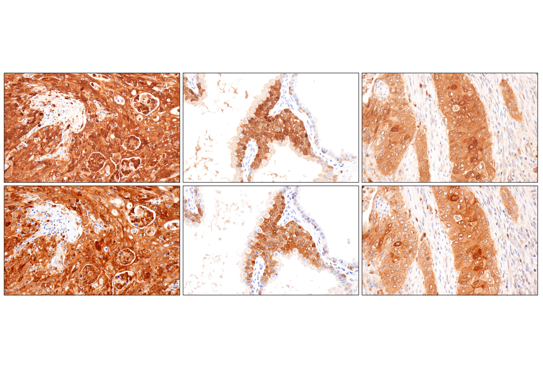 Immunohistochemistry Image 12: Cystatin-A (F5N5B) Rabbit Monoclonal Antibody