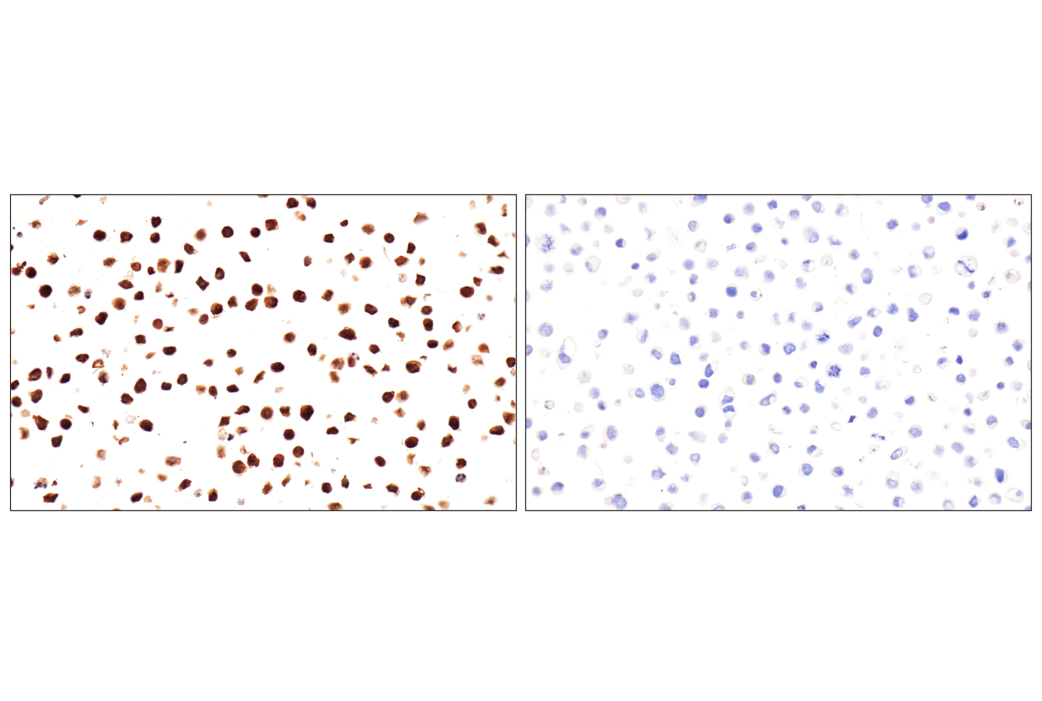 Immunohistochemistry Image 14: Cystatin-A (F5N5B) Rabbit Monoclonal Antibody