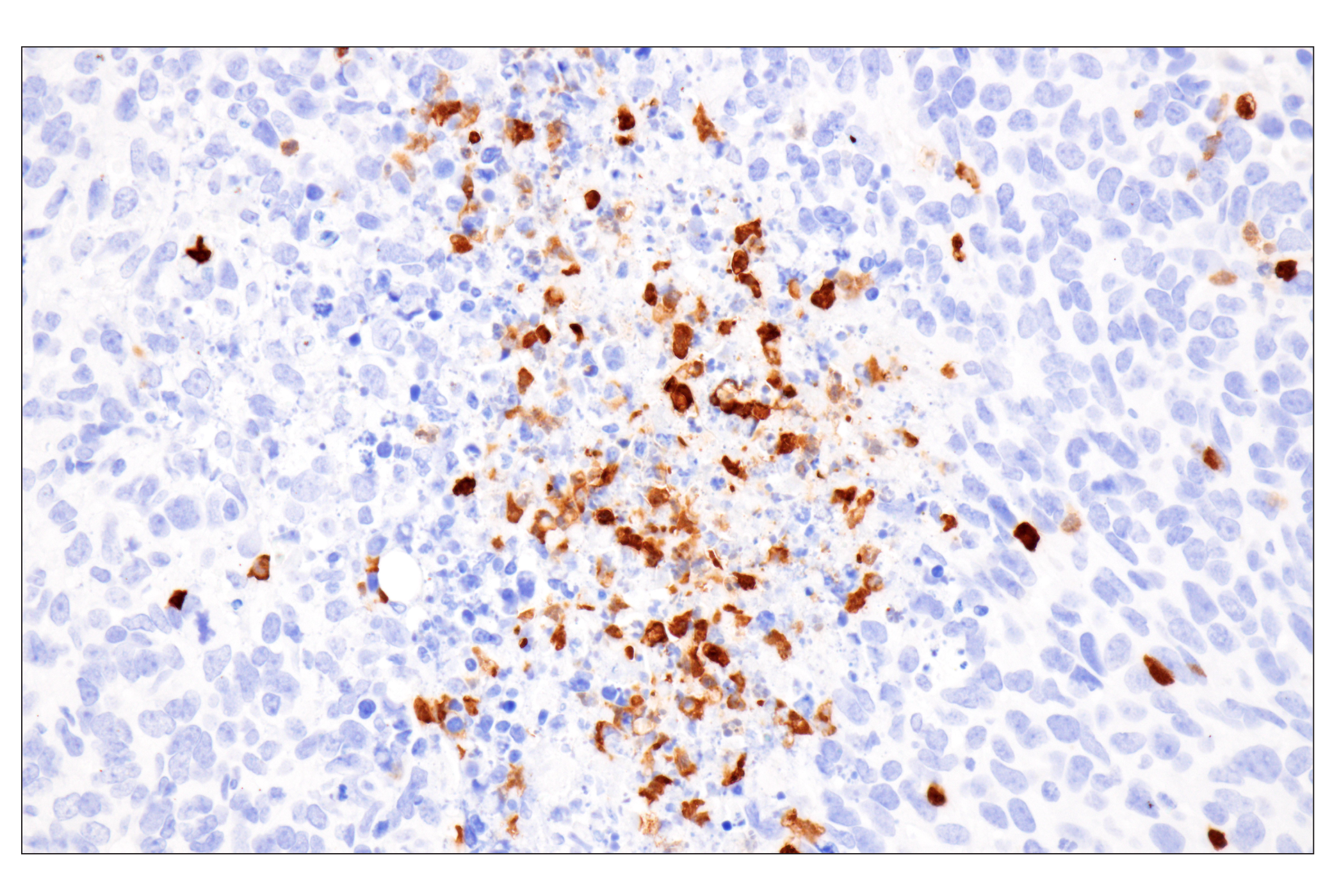 Immunohistochemistry Image 9: Cystatin-A (F5N5B) Rabbit Monoclonal Antibody
