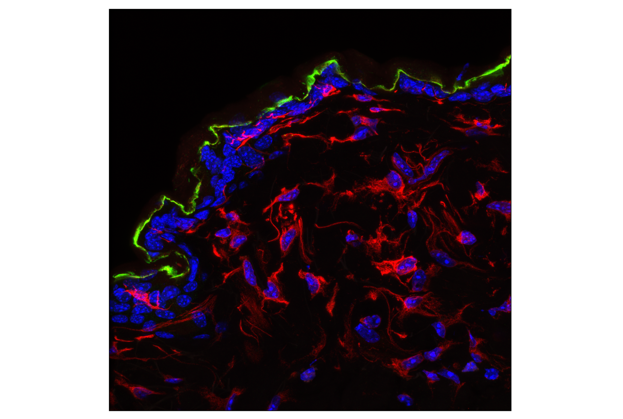 Immunofluorescence Image 1: Cystatin-A (F5N5B) Rabbit Monoclonal Antibody
