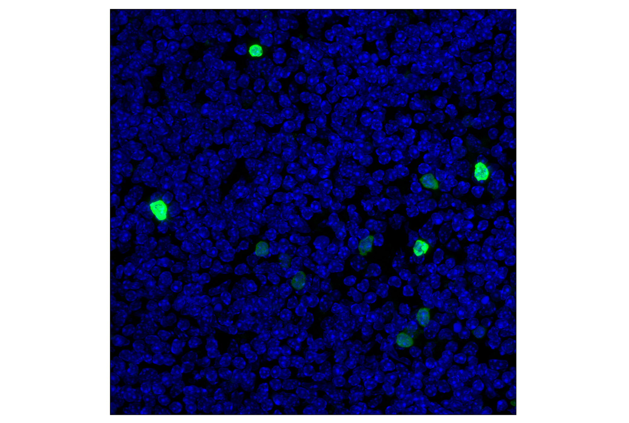 Immunofluorescence Image 2: Cystatin-A (F5N5B) Rabbit Monoclonal Antibody