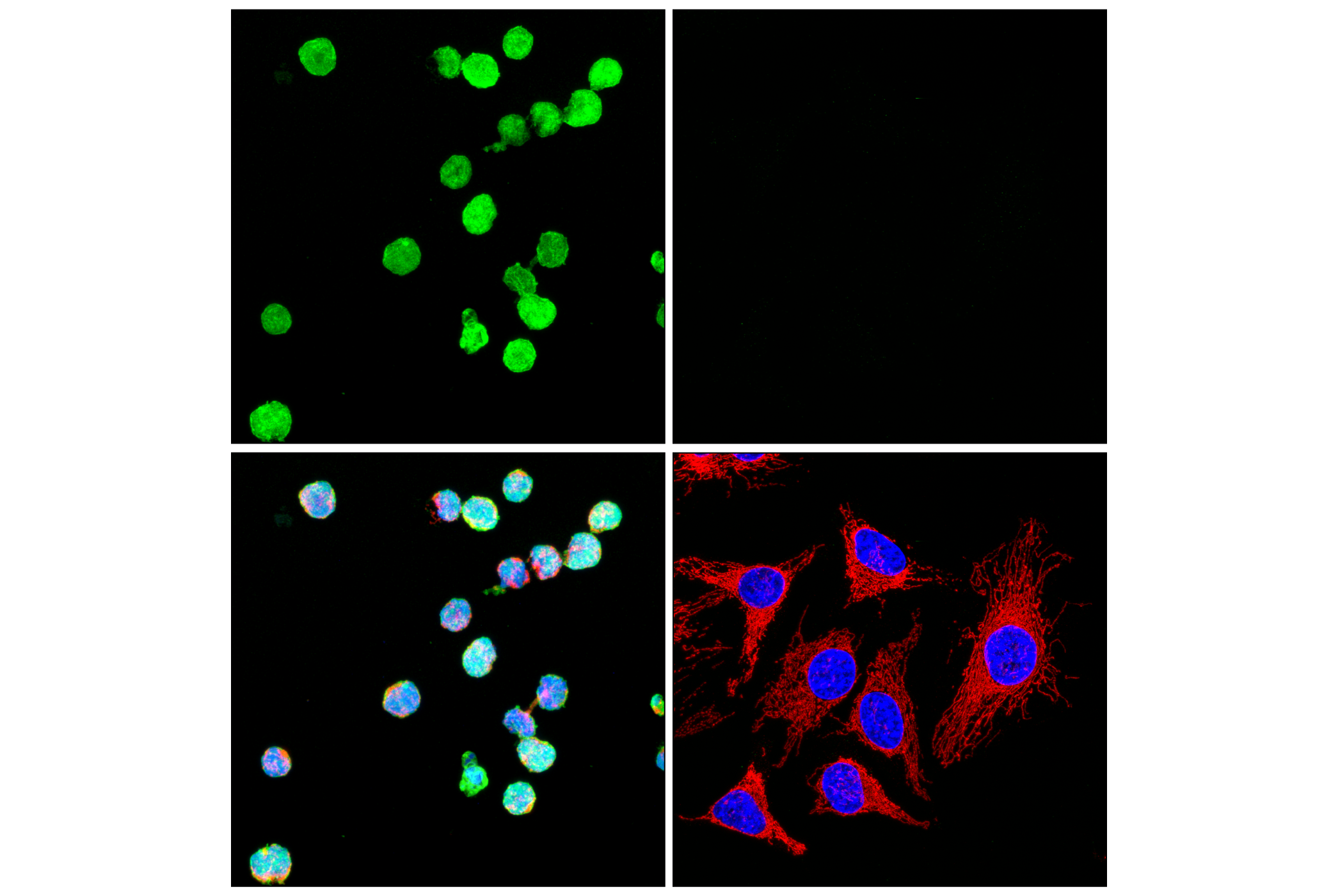 Immunofluorescence Image 1: Cystatin-A (F5N5B) Rabbit Monoclonal Antibody