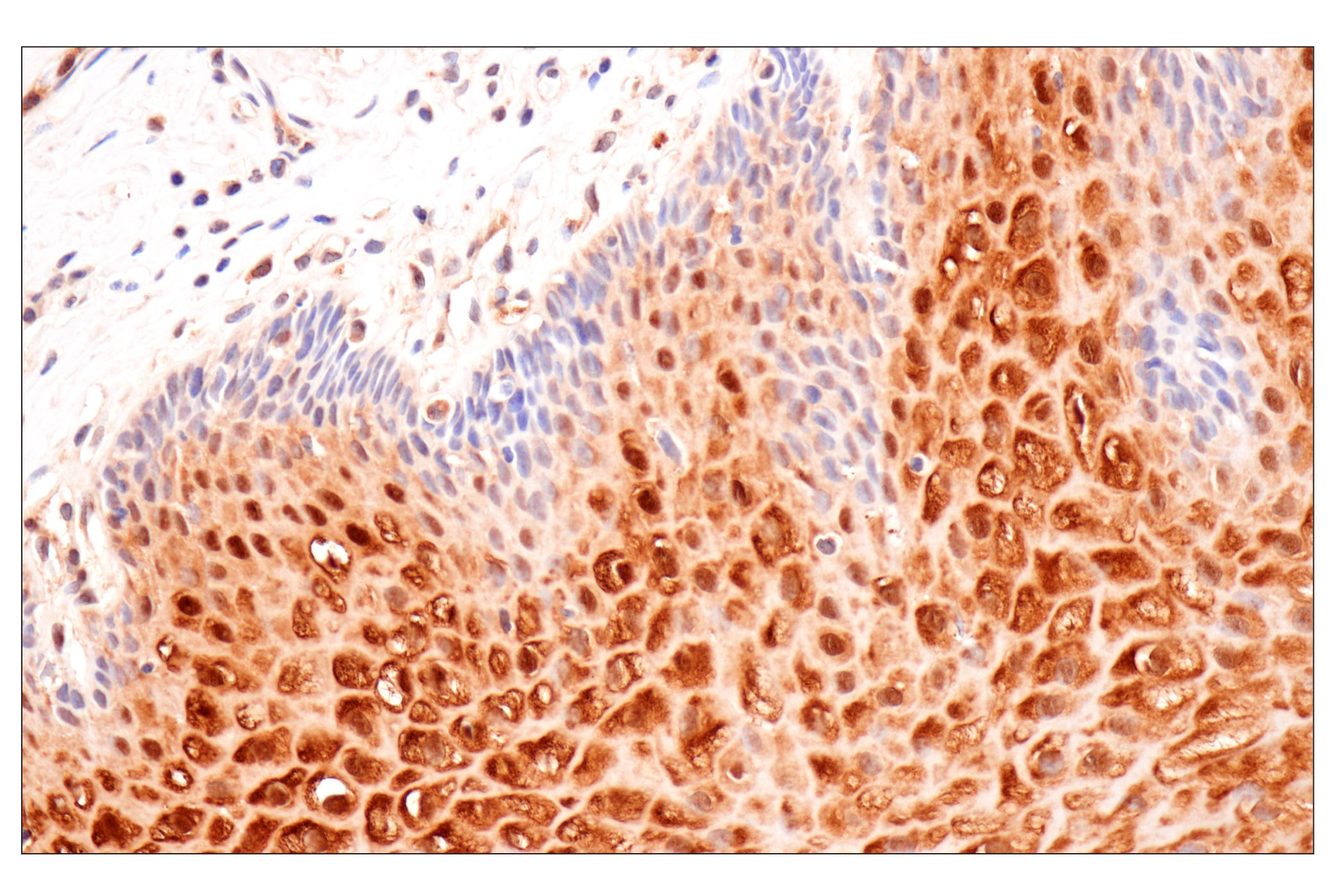 Immunohistochemistry Image 6: Cystatin-A (F5N5B) Rabbit Monoclonal Antibody