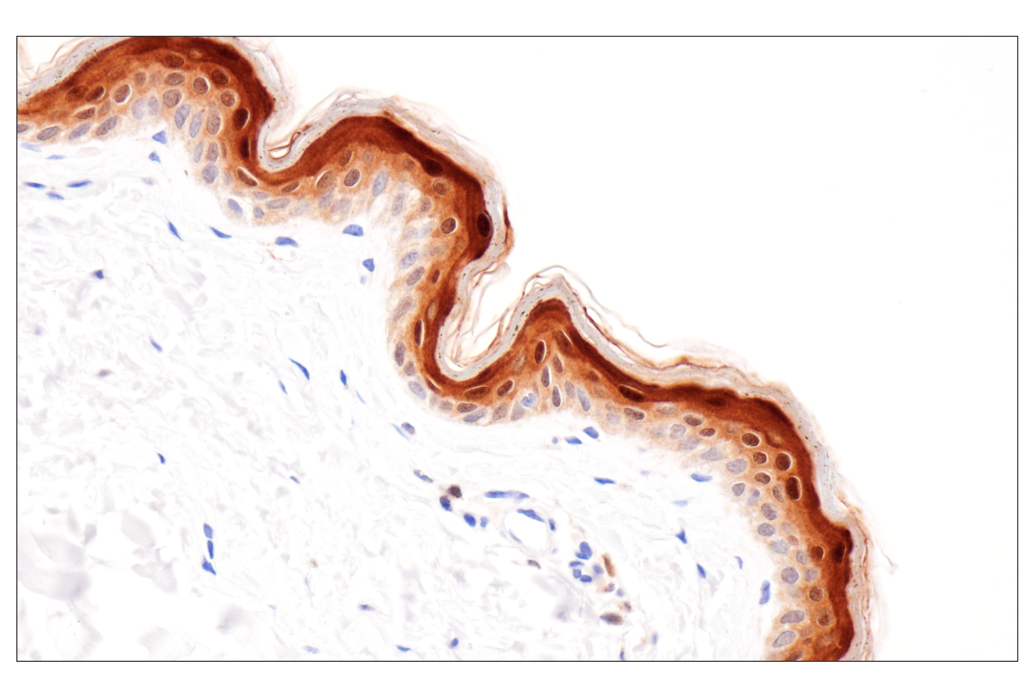 Immunohistochemistry Image 8: Cystatin-A (F5N5B) Rabbit Monoclonal Antibody