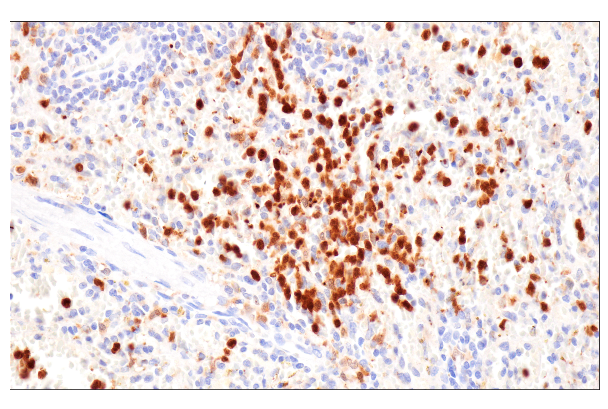 Immunohistochemistry Image 7: Cystatin-A (F5N5B) Rabbit Monoclonal Antibody