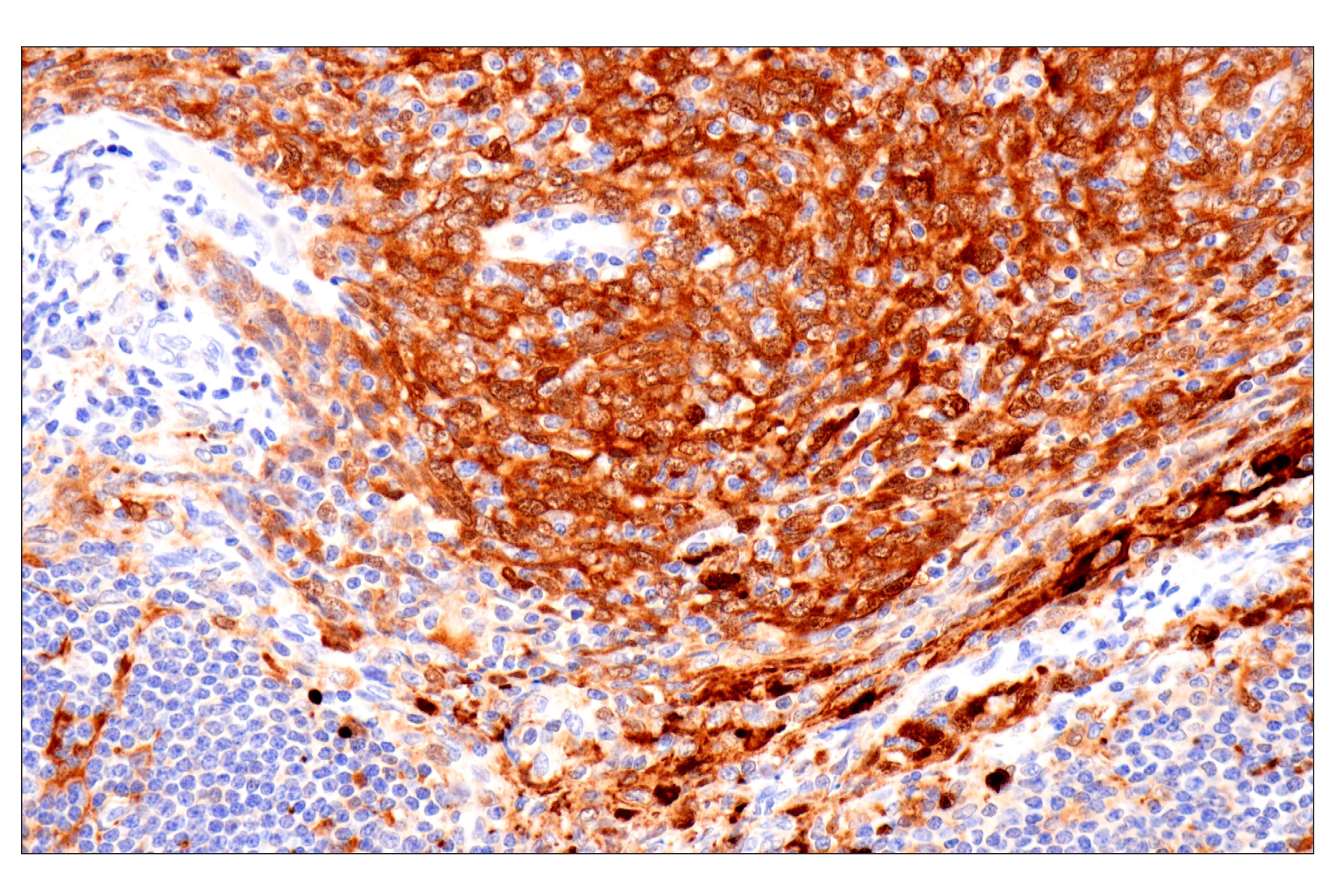 Immunohistochemistry Image 3: Cystatin-A (F5N5B) Rabbit Monoclonal Antibody
