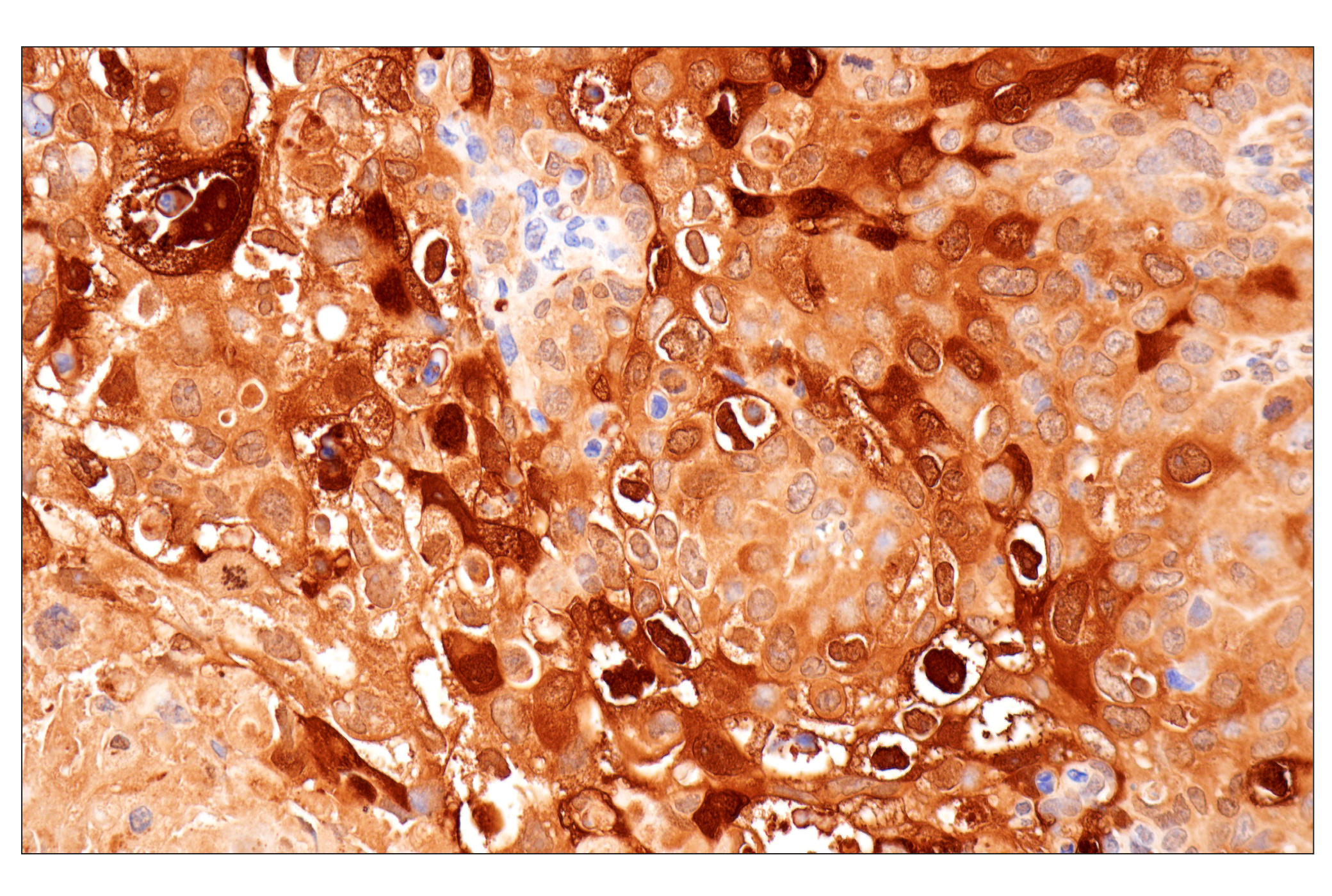 Immunohistochemistry Image 1: Cystatin-A (F5N5B) Rabbit Monoclonal Antibody
