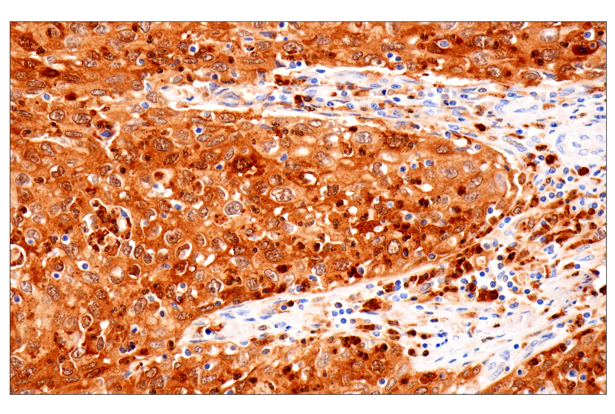 Immunohistochemistry Image 5: Cystatin-A (F5N5B) Rabbit Monoclonal Antibody
