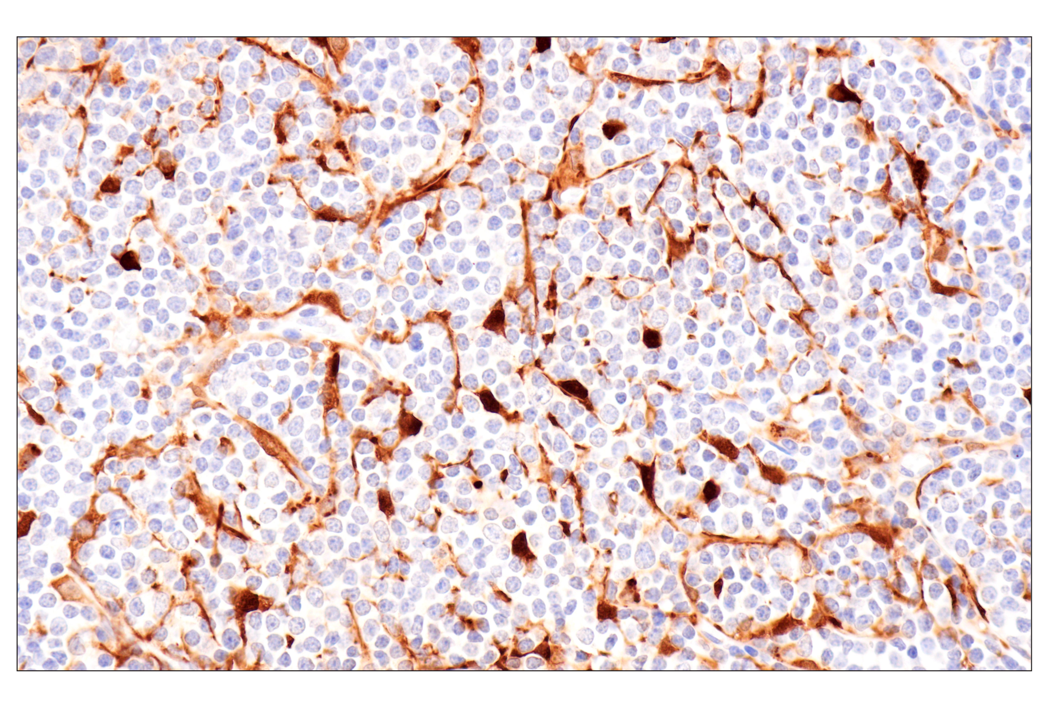 Immunohistochemistry Image 2: Cystatin-A (F5N5B) Rabbit Monoclonal Antibody