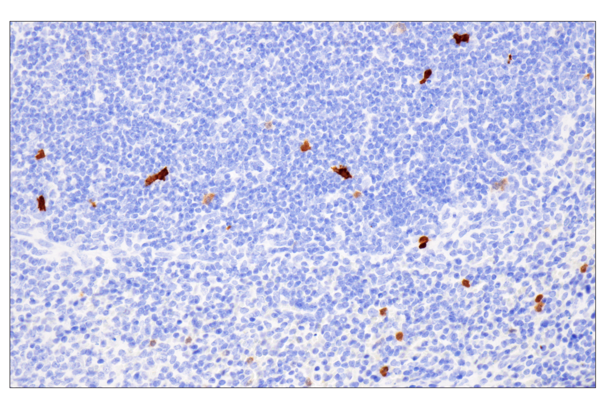 Immunohistochemistry Image 11: Cystatin-A (F5N5B) Rabbit Monoclonal Antibody