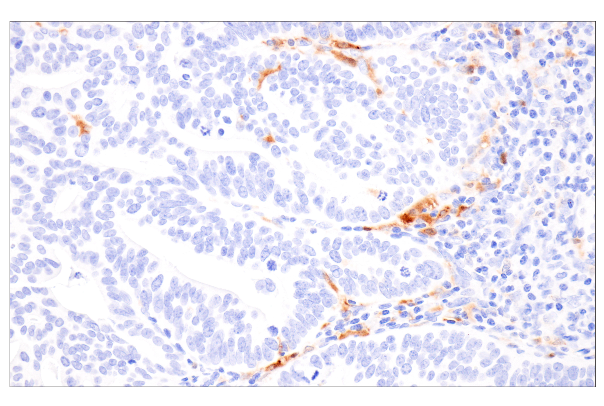 Immunohistochemistry Image 4: Cystatin-A (F5N5B) Rabbit Monoclonal Antibody