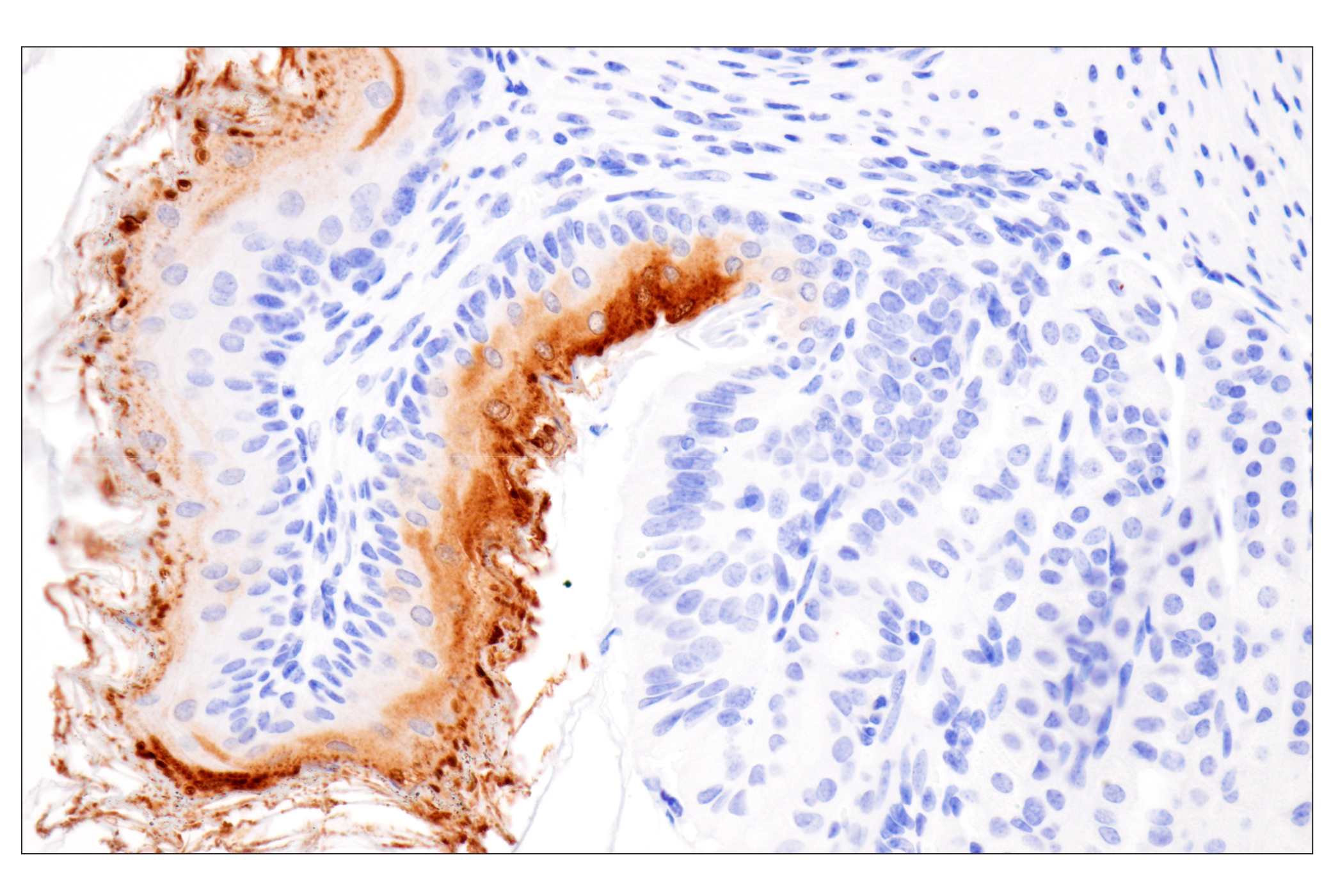 Immunohistochemistry Image 10: Cystatin-A (F5N5B) Rabbit Monoclonal Antibody