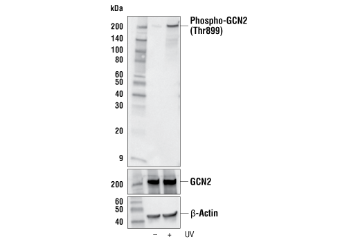  Image 2: PhosphoPlus ® GCN2 (Thr899) Antibody Duet