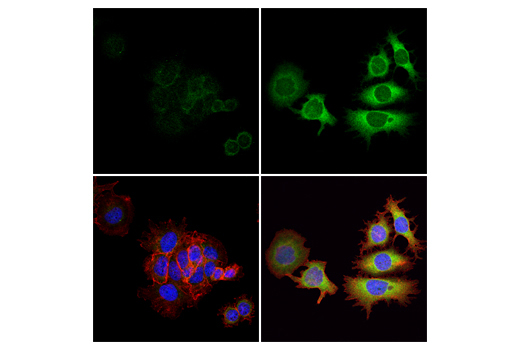 Immunofluorescence Image 1: Phospho-GCN2 (Thr899) (E1V9M) Rabbit mAb