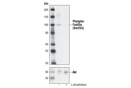 Western Blotting Image 1: Phospho-FoxO3a (Ser253) Antibody