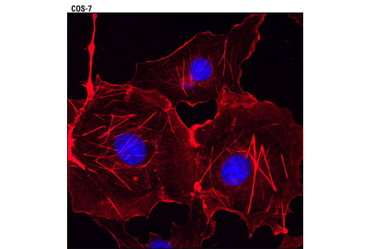 Immunofluorescence Image 1: β-Actin (13E5) Rabbit mAb (Alexa Fluor® 594 Conjugate)