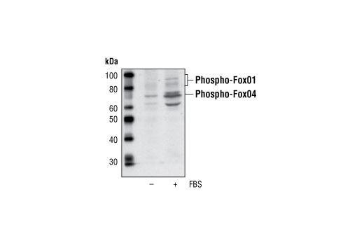 Western Blotting Image 1: Phospho-FoxO4 (Ser193) Antibody