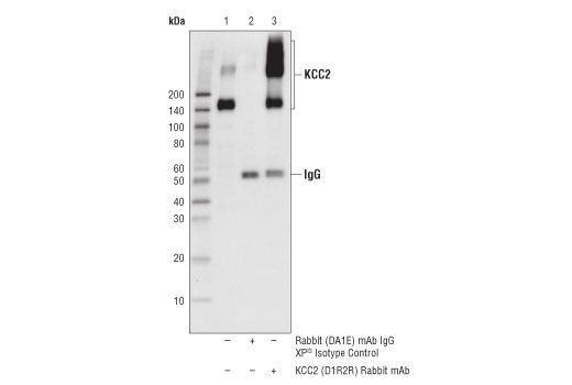 Immunoprecipitation Image 1: KCC2 (D1R2R) Rabbit mAb