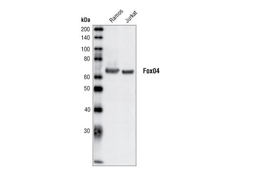 Western Blotting Image 1: FoxO4 Antibody