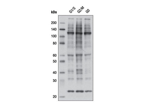  Image 5: Phospho-(Ser) Kinase Substrate Antibody Sampler Kit